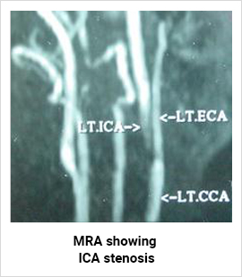 Magnetic resonance angiography